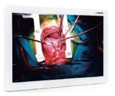 ADLINK/PENTA ASM27UHB 27  4K Surgical Touch-Monitor